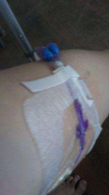 PICC Line first one in my life I was made to be on