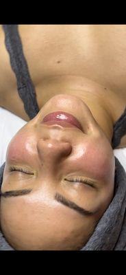 Custom facial with added dermaplane. Reveals smooth, bright skin. Showing instant results.