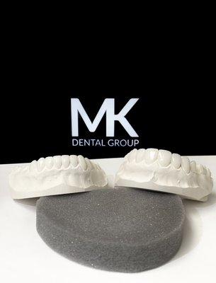 Upper and Lower Porcelain Veneers customized to each individual patient.