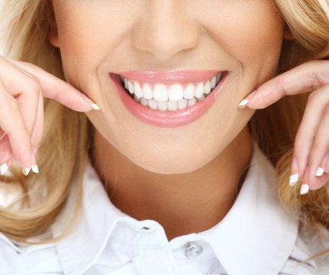 Dental Veneers