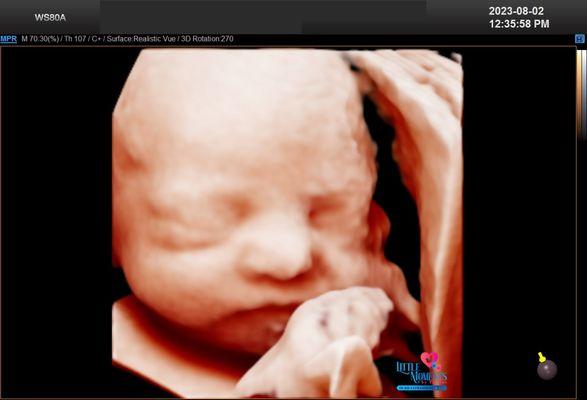 Little Moments 5D HD Ultrasound & Spa