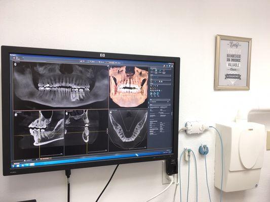 The Latest 3D imaging to plan for your implants. We use surgical guide for accuracy of implant placement.