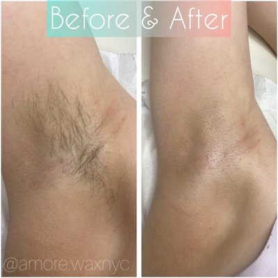 Before and After Under Arm Wax 
Leaves a silky smooth finish to your skin.