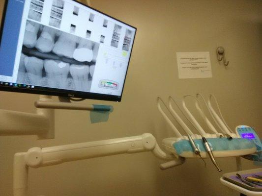 I love the monitor that showing my teeth X Ray.