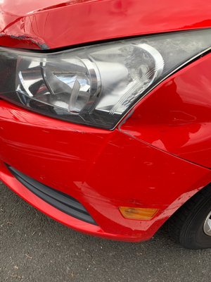 Auto body damage