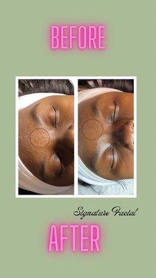 Signature facial