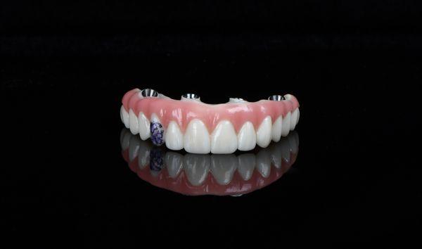 All on Four, Full Arch Zirconia implant with a custom tattoo on the tooth