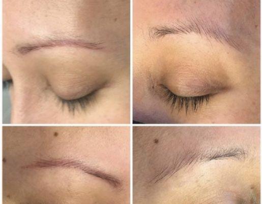 Saline brow lightening.. we can help with unwanted brow tattoo lightening to start with a fresh new set!!