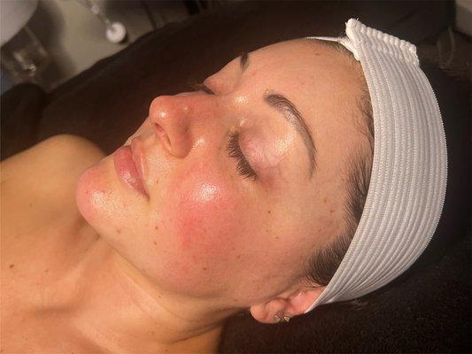 CBD infused facial with LED light therapy