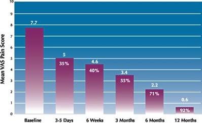 Excellence Shock Wave Therapy