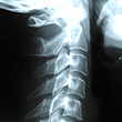 Specific x-rays for a specific adjustment.