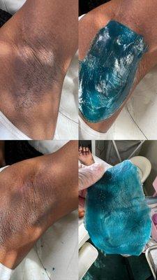 Before & After pictures after an underarm wax