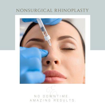 Non-Surgical Rhinoplasty offers incredible results with no downtime!