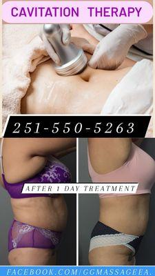 CAVITATION THERAPY