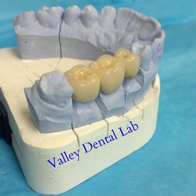 Valley Dental Lab