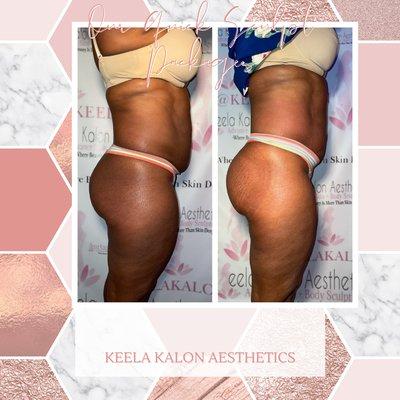 Nu'Bella Body Aesthetics