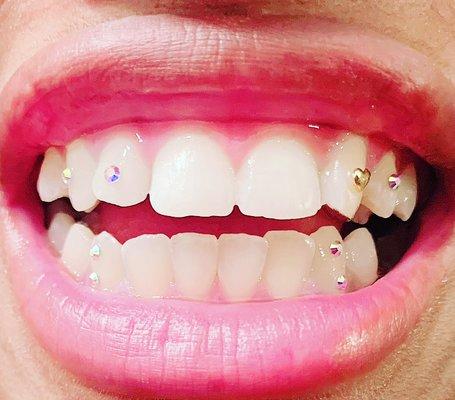 Teeth Jewelry/Gems