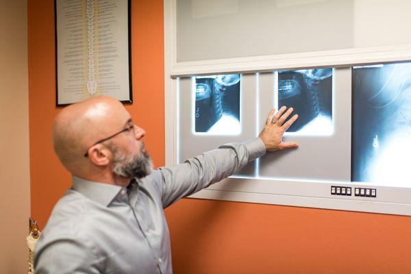 We use x-rays to compliment our chiropractic care and to document changes in your condition.