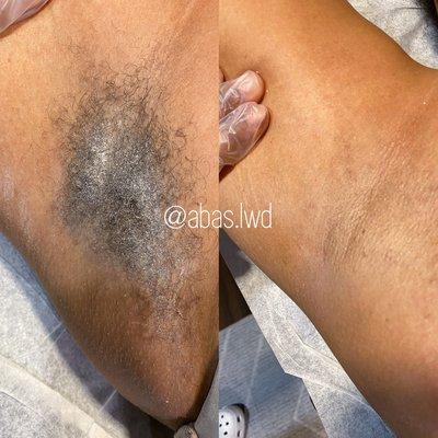 Underarm Wax