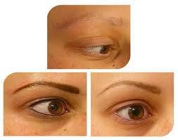 Powdered looking brow. Before, after and healed .