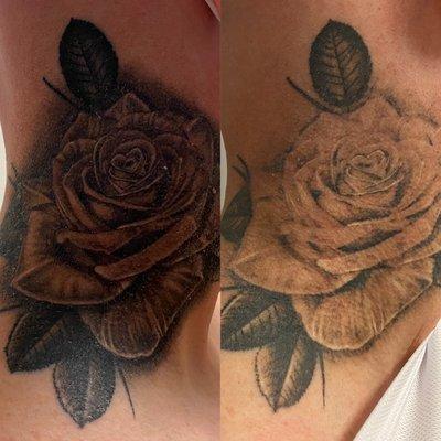 Before and after one Laser Tattoo Removal Treatment