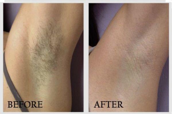 Underarm Wax