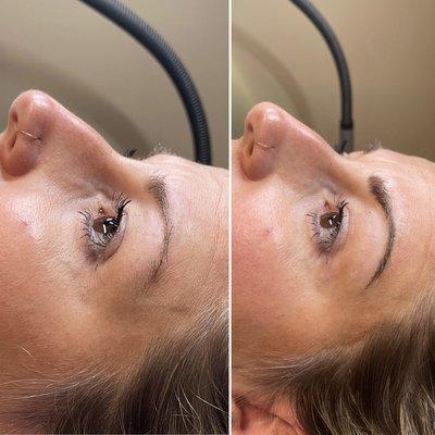 Shading and Microblading combination