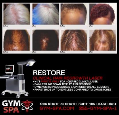 NJ's FIRST FDA-Cleared Hair Regrowth Laser System