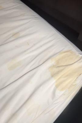 Stain on sheets bodily fluids