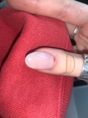 cut and redness on finger.