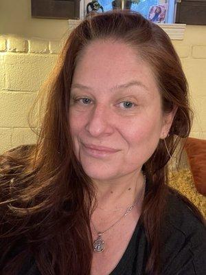 Me, today, post IV ozone. No filters. No makeup, just 49 years old and absolutely NOT dead.