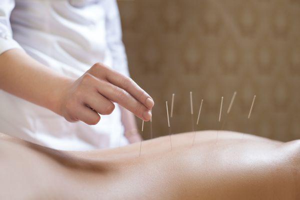 Sundhari Acupuncture