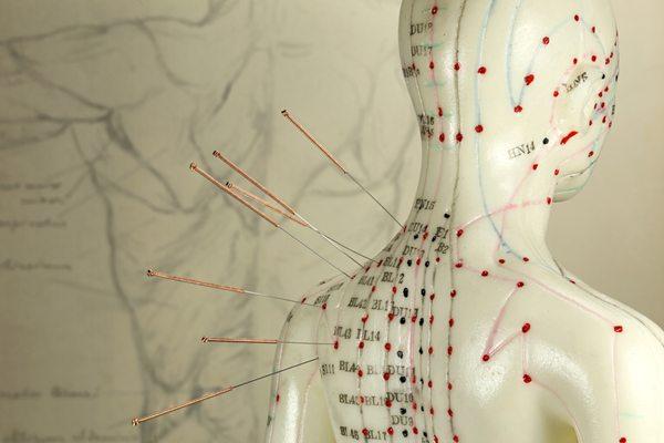 Acupuncture can be used to treat almost all medical problems! Call to see if your can be treated.