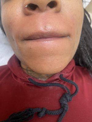 Upper Lip and Chin Waxing