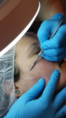 Dermaplaning is a great way to slough off dead skin cells & remove unwanted facial hair leaving your skin feeling smooth & glowing.