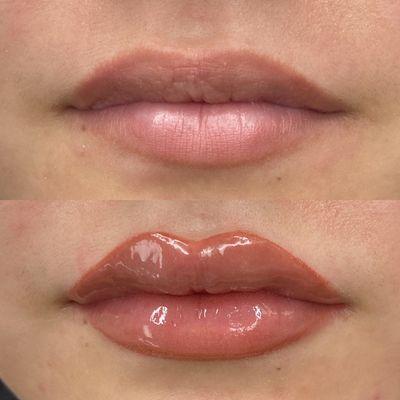 Before and after lip blush