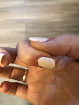 This thumb nail was also too big so it has a chip where she tried to file it. Just so sloppy and awful.