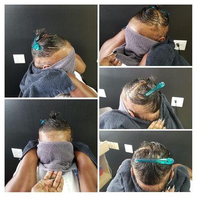 Specialize in camouflaging. Client has alopecia