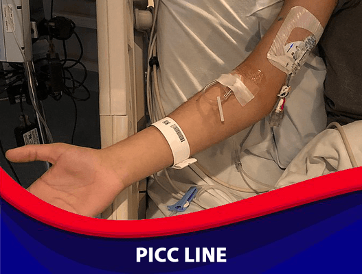 PICC-line placement