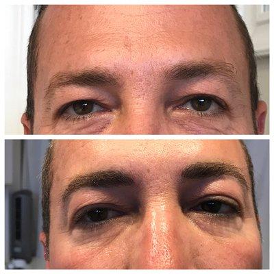 Men's thinning and  Microbladed Brows