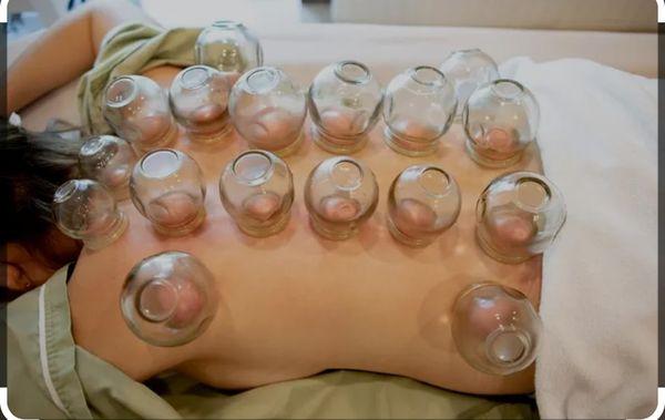 Cupping help go away stress