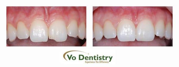 Restorative Dentistry