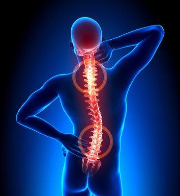 Severe back pain? Spine is connected with all organs.We should take care of spin at least 3 times a a day.  Improves overall health!!
 ​