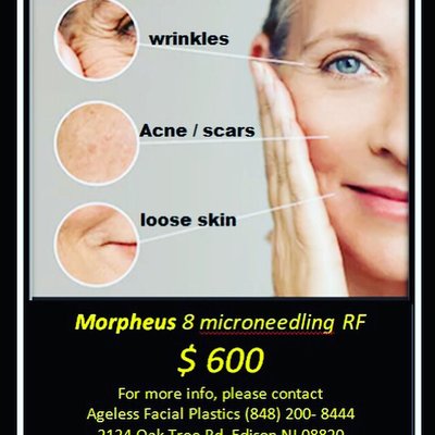 Skin tightening , acne treatment