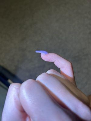 Extremely uneven and bumpy nail