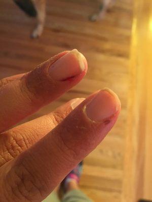 Bleeding fingers. Not my ideal manicure.