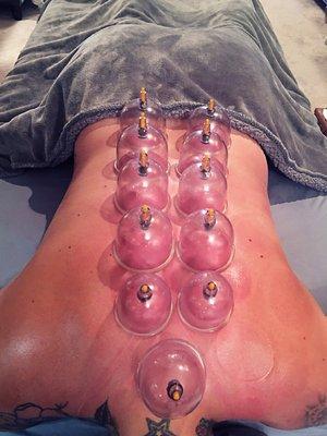 Cupping Session