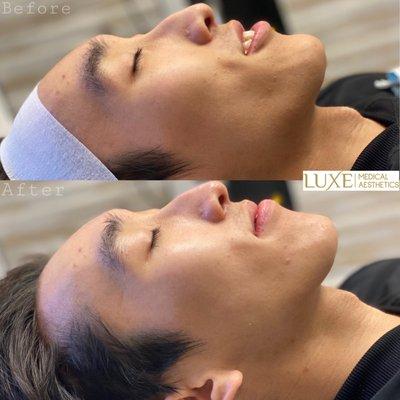 Signature Facial