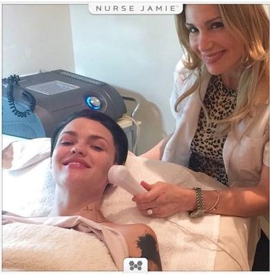 Nurse Jamie & Ruby Rose | ACELLerator Facial