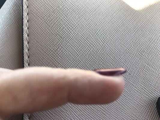 My nail looks pulled up and thick and lumpy